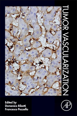 Abbildung von Ribatti / Pezzella | Tumor Vascularization | 1. Auflage | 2020 | beck-shop.de