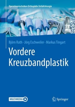 Abbildung von Rath / Eschweiler | Vordere Kreuzbandplastik | 1. Auflage | 2019 | beck-shop.de