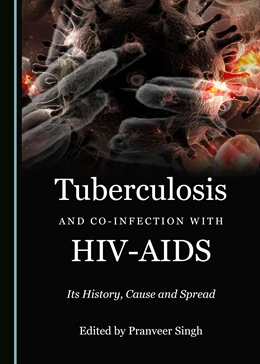 Abbildung von Tuberculosis and Co-infection with HIV-AIDS | 1. Auflage | 2019 | beck-shop.de