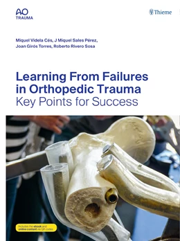 Abbildung von Videla Cés / Rivero Sosa | Learning From Failures in Orthopedic Trauma | 1. Auflage | 2019 | beck-shop.de