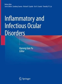Abbildung von Yu | Inflammatory and Infectious Ocular Disorders | 1. Auflage | 2019 | beck-shop.de