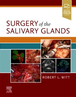 Abbildung von Witt | Surgery of the Salivary Glands | 1. Auflage | 2020 | beck-shop.de