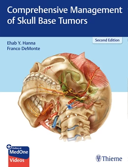 Abbildung von DeMonte / Hanna | Comprehensive Management of Skull Base Tumors | 2. Auflage | 2021 | beck-shop.de