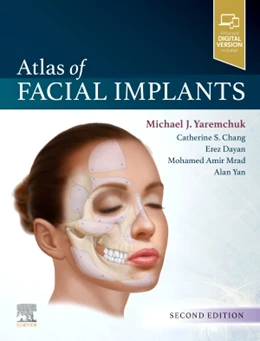 Abbildung von Yaremchuk | Atlas of Facial Implants | 2. Auflage | 2019 | beck-shop.de