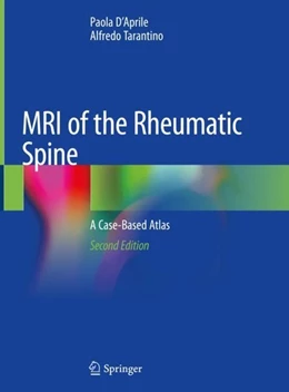 Abbildung von D'Aprile / Tarantino | MRI of the Rheumatic Spine | 2. Auflage | 2019 | beck-shop.de