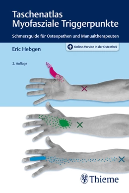 Abbildung von Hebgen | Taschenatlas Myofasziale Triggerpunkte | 2. Auflage | 2020 | beck-shop.de