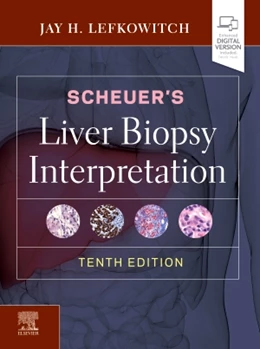 Abbildung von Lefkowitch | Scheuer's Liver Biopsy Interpretation | 10. Auflage | 2020 | beck-shop.de