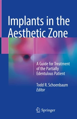 Abbildung von Schoenbaum | Implants in the Aesthetic Zone | 1. Auflage | 2018 | beck-shop.de