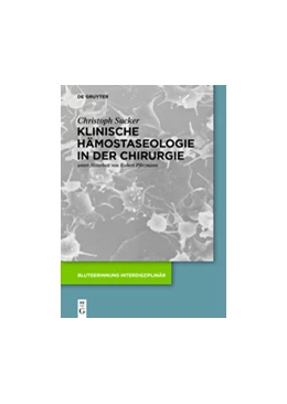 Abbildung von Sucker | Klinische Hämostaseologie in der Chirurgie | 1. Auflage | 2016 | beck-shop.de