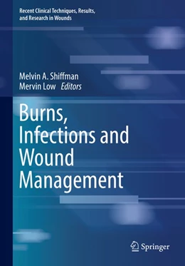 Abbildung von Shiffman / Low | Burns, Infections and Wound Management | 1. Auflage | 2020 | beck-shop.de