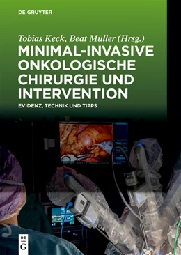 Abbildung von Keck / Müller | Minimal-invasive Onkologische Chirurgie und Intervention | 1. Auflage | 2024 | beck-shop.de
