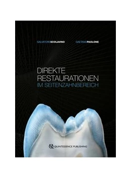Abbildung von Scolavino / Paolone | Direkte Restaurationen im Seitenzahnbereich | 1. Auflage | 2020 | beck-shop.de