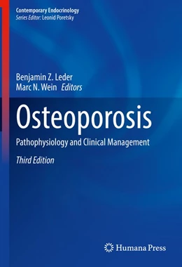 Abbildung von Leder / Wein | Osteoporosis | 3. Auflage | 2020 | beck-shop.de