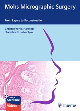 Abbildung von Harmon / Tolkachjov | Mohs Micrographic Surgery: From Layers to Reconstruction | 1. Auflage | 2023 | beck-shop.de