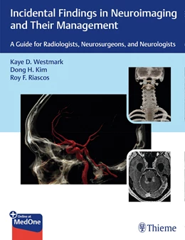 Abbildung von Westmark / Kim | Incidental Findings in Neuroimaging and Their Management | 1. Auflage | 2020 | beck-shop.de