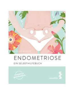 Abbildung von Hofmeister | Endometriose | 1. Auflage | 2020 | beck-shop.de