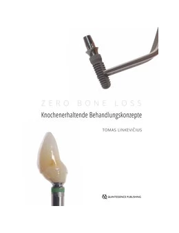 Abbildung von Linkevicius | Zero Bone Loss: Knochenerhaltende Behandlungskonzepte | 1. Auflage | 2020 | beck-shop.de