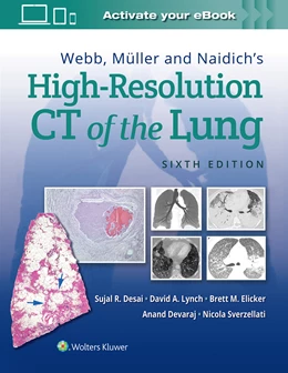 Abbildung von Desai / Lynch | Webb, Muller and Naidich's High Resolution of Lung CT | 6. Auflage | 2021 | beck-shop.de