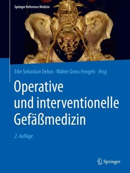 Abbildung von Debus / Gross-Fengels | Operative und interventionelle Gefäßmedizin | 2. Auflage | 2020 | beck-shop.de