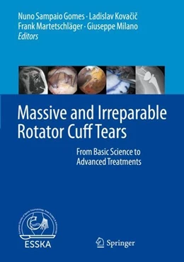 Abbildung von Sampaio Gomes / Kovacic | Massive and Irreparable Rotator Cuff Tears | 1. Auflage | 2020 | beck-shop.de