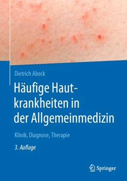 Abbildung von Abeck | Häufige Hautkrankheiten in der Allgemeinmedizin | 3. Auflage | 2020 | beck-shop.de