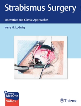 Abbildung von Ludwig | Strabismus Surgery | 1. Auflage | 2021 | beck-shop.de