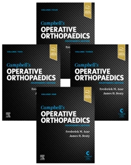 Abbildung von Azar / Canale | Campbell's Operative Orthopaedics, 4-Volume Set | 14. Auflage | 2020 | beck-shop.de