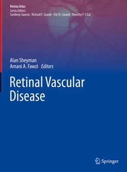 Abbildung von Sheyman / Fawzi | Retinal Vascular Disease | 1. Auflage | 2020 | beck-shop.de