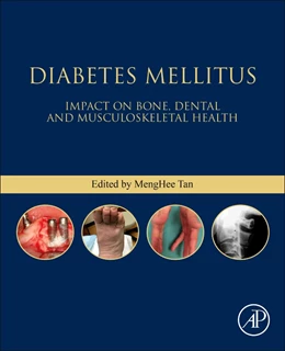 Abbildung von Tan | Diabetes Mellitus | 1. Auflage | 2020 | beck-shop.de