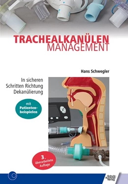 Abbildung von Schwegler | Trachealkanülenmanagement | 3. Auflage | 2019 | beck-shop.de