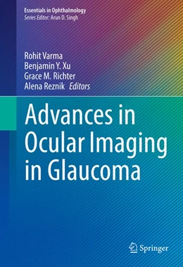Abbildung von Varma / Xu | Advances in Ocular Imaging in Glaucoma | 1. Auflage | 2020 | beck-shop.de