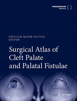 Abbildung von Fayyaz | Surgical Atlas of Cleft Palate and Palatal Fistulae | 1. Auflage | 2022 | beck-shop.de