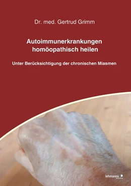Abbildung von Grimm | Autoimmunerkrankungen homöopathisch heilen | 1. Auflage | 2020 | beck-shop.de