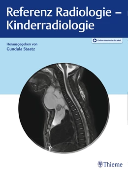 Abbildung von Staatz | Referenz Radiologie - Kinderradiologie | 1. Auflage | 2022 | beck-shop.de