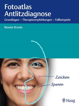 Abbildung von Droste | Fotoatlas Antlitzdiagnose | 1. Auflage | 2020 | beck-shop.de
