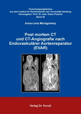 Abbildung von Montgomery | Post mortem CT und CT-Angiografie nach Endovaskulärer Aortenreparatur (EVAR) | 1. Auflage | 2020 | 38 | beck-shop.de