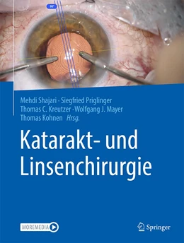 Abbildung von Shajari / Priglinger | Katarakt- und Linsenchirurgie | 1. Auflage | 2023 | beck-shop.de