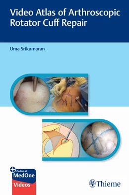Abbildung von Srikumaran | Video Atlas of Arthroscopic Rotator Cuff Repair | 1. Auflage | 2021 | beck-shop.de