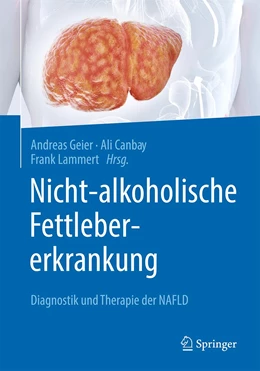 Abbildung von Geier / Canbay | Nicht-alkoholische Fettlebererkrankung | 1. Auflage | 2022 | beck-shop.de