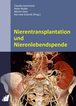 Abbildung von Sommerer / Nickel | Nierentransplantation und Nierenlebendspende | 1. Auflage | 2020 | beck-shop.de