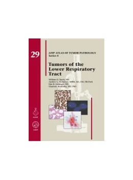 Abbildung von Tumors of the Lower Respiratory Tract | 1. Auflage | 2019 | beck-shop.de