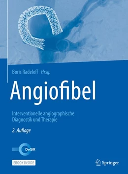 Abbildung von Radeleff | Angiofibel | 2. Auflage | 2020 | beck-shop.de