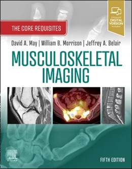 Abbildung von May / Morrison | Musculoskeletal Imaging | 5. Auflage | 2021 | beck-shop.de