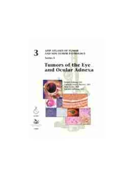 Abbildung von Tumors of the Eye and Ocular Adnexa | 1. Auflage | 2021 | beck-shop.de