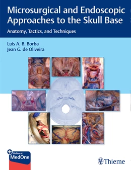 Abbildung von Borba / de Oliveira | Microsurgical and Endoscopic Approaches to the Skull Base | 1. Auflage | 2021 | beck-shop.de