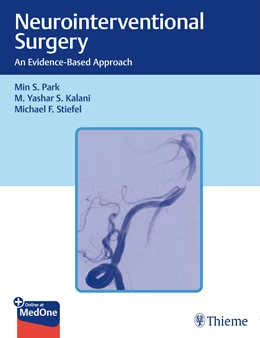 Abbildung von Park / Kalani | Neurointerventional Surgery | 1. Auflage | 2021 | beck-shop.de