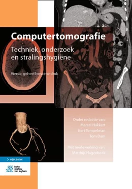 Abbildung von Hakkert / Tempelman | Computertomografie | 4. Auflage | 2021 | beck-shop.de
