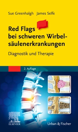 Abbildung von Greenhalgh / Selfe | Red Flags bei schweren Wirbelsäulenerkrankungen | 2. Auflage | 2021 | beck-shop.de