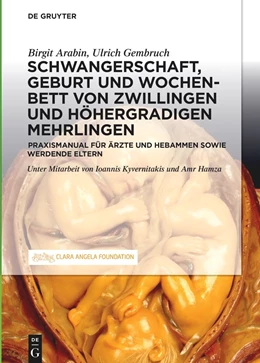 Abbildung von Arabin / Gembruch | Zwillings- oder Mehrlingsschwangerschaft und -Geburt | 1. Auflage | 2021 | beck-shop.de