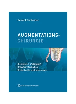 Abbildung von Terheyden | Augmentationschirurgie | 1. Auflage | 2021 | beck-shop.de